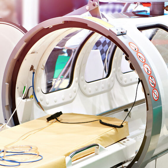 Câmara Hiperbárica A câmara hiperbárica também conhecida como oxigenoterapia é um tratamento baseado na respiração de oxigênio puro