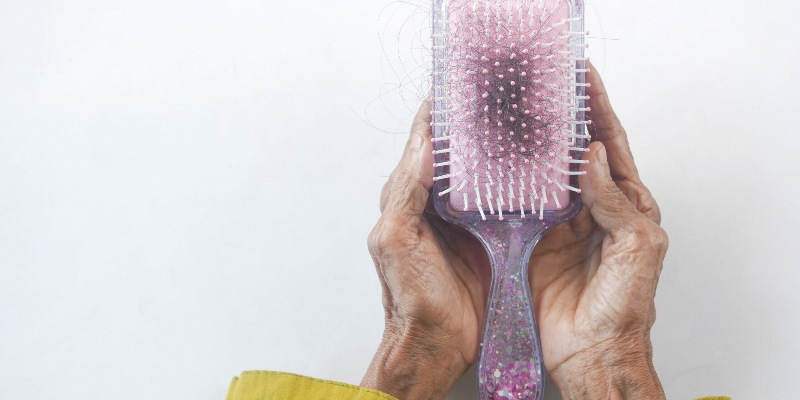 Síndrome dos Ovários Policísticos Síndrome dos Ovários Policísticos