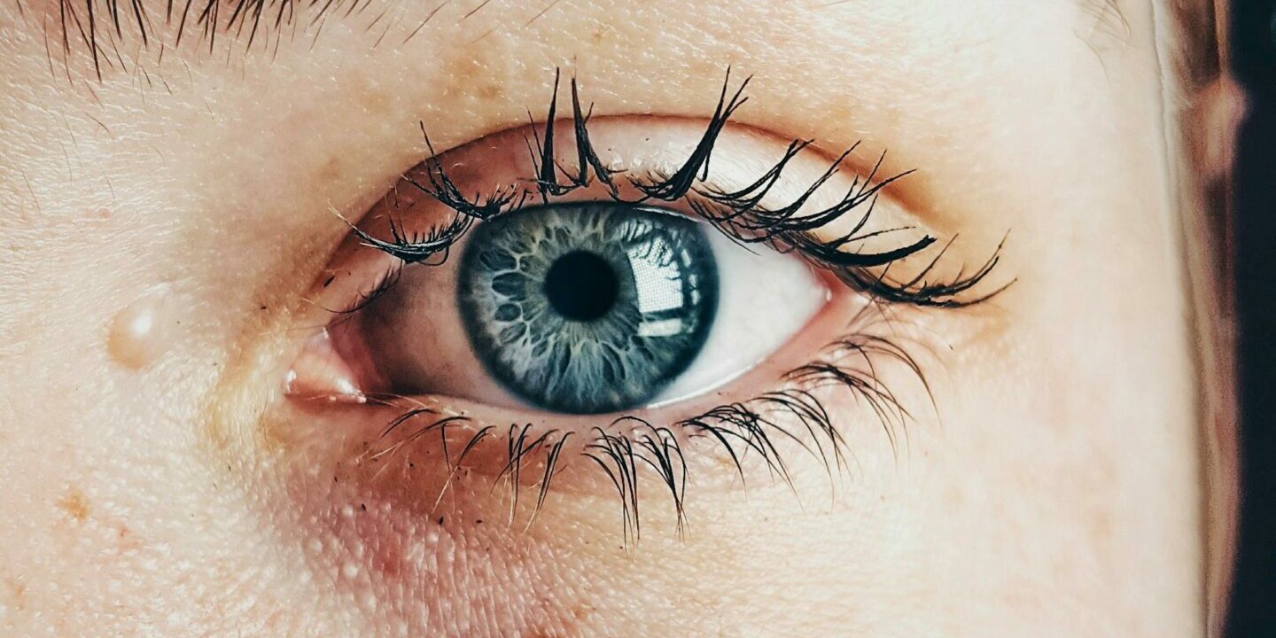 Olheiras, adeus! Dra. Ligia Novais explica para a GQ como tratar